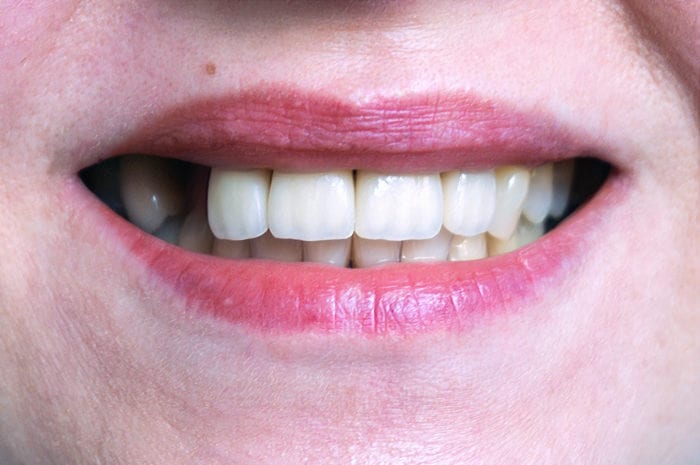 Treatment for Missing Teeth in Timonium, MD