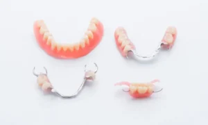 The Truth About Tooth Loss | in Timonium, MD